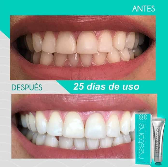 RESTORE GEL DENTAL - Blanqueador con Nanotecnología