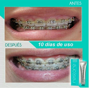 RESTORE GEL DENTAL - Blanqueador con Nanotecnología