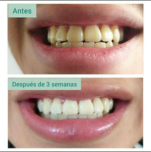 RESTORE GEL DENTAL - Blanqueador con Nanotecnología